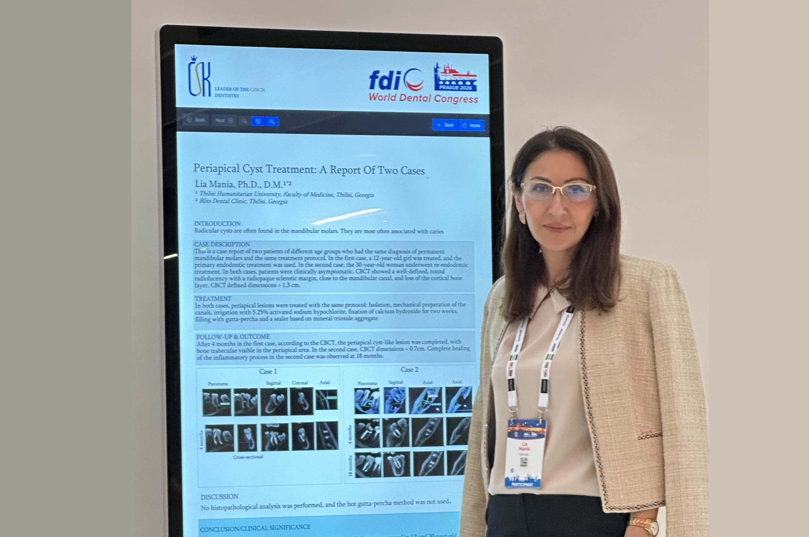 თჰუ-ის ასოცირებული პროფესორი ლია მანია FDI World Dental Congress 2026-ზე